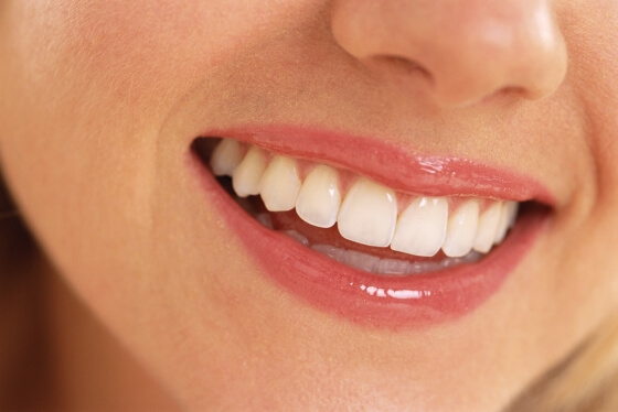 We are now offering Cfast smiles