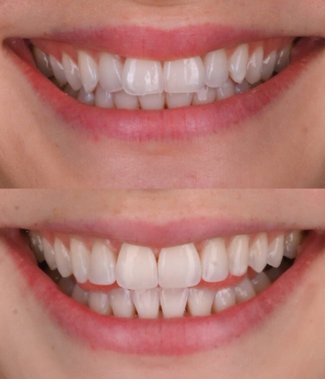 Closeup of the same result