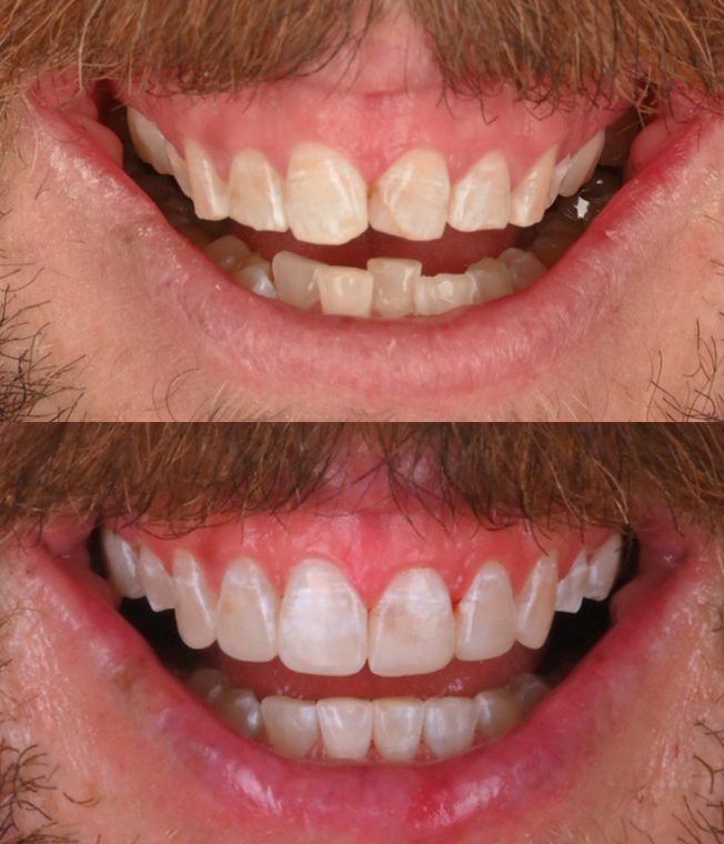 Closeup of the same result