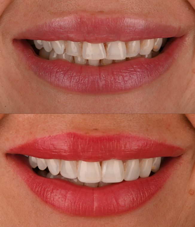 Closeup of the same result