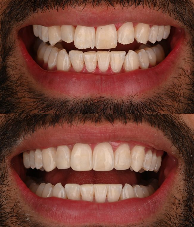 Closeup of the same result