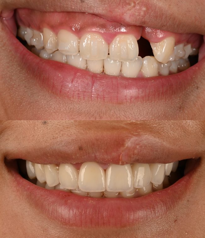 Closeup of the same result