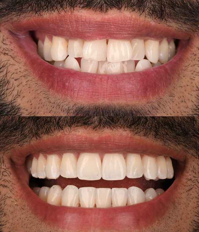 Closeup of the same result