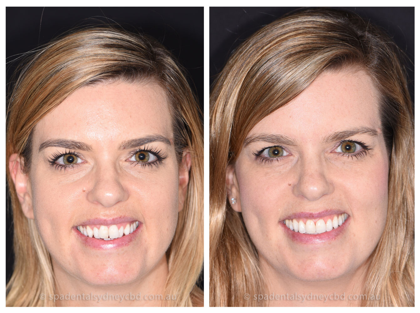 Michelle Smile Face