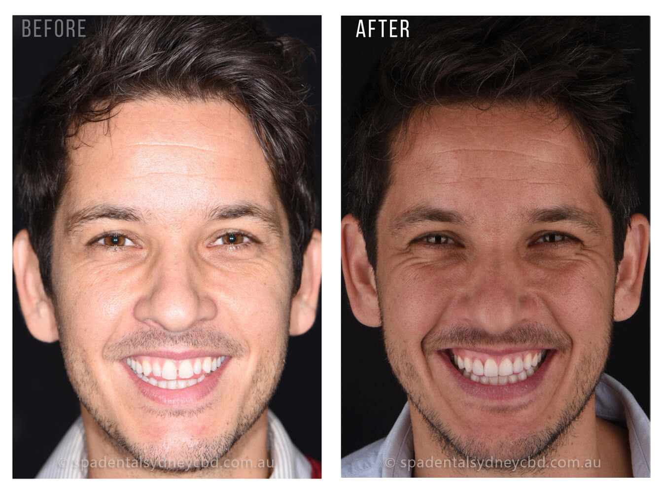 Miguel Smile Face